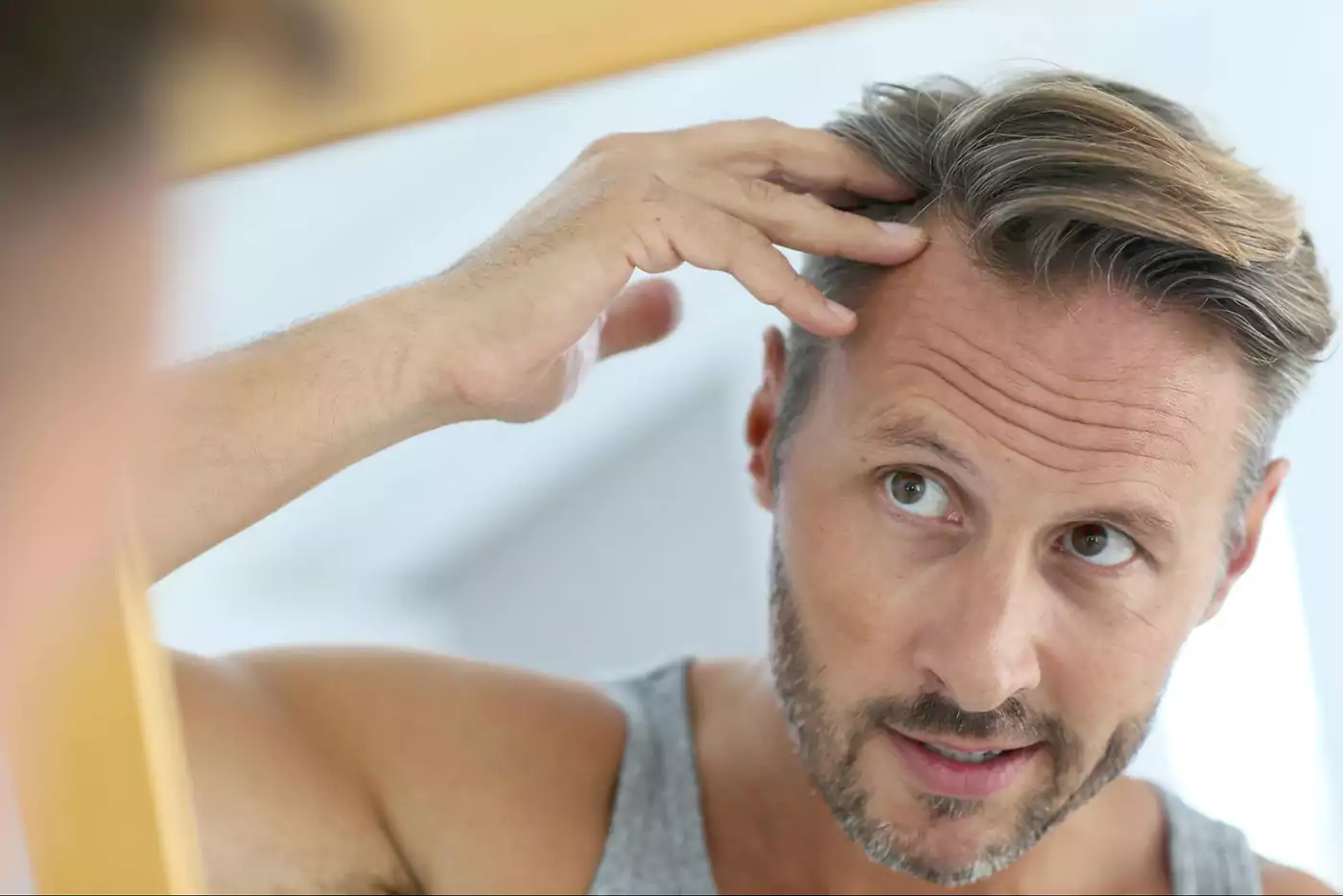 los angeles hair restoration clinic